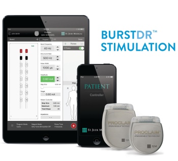 Spinal Cord Stimulator – Treatment for Chronic Pain